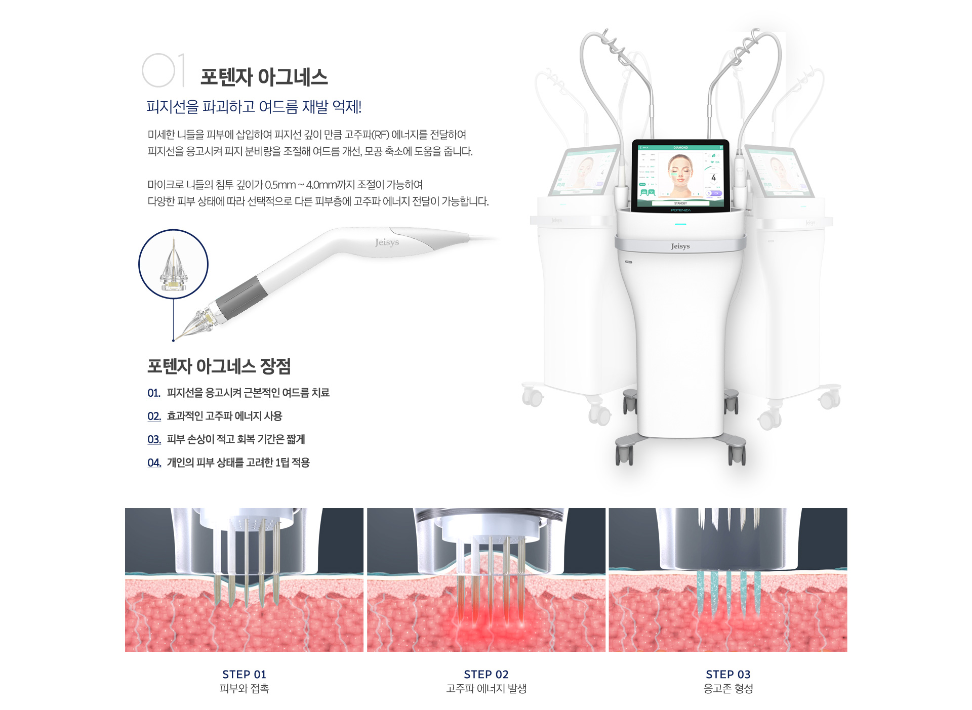 포텐자 아그네스 레이저
