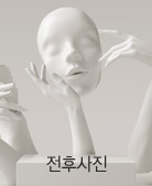 전후사진